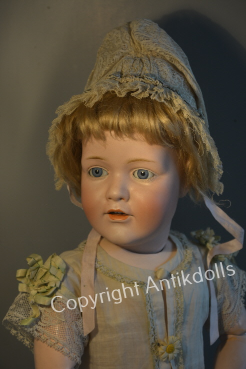 Kestner 241 Kestner 241